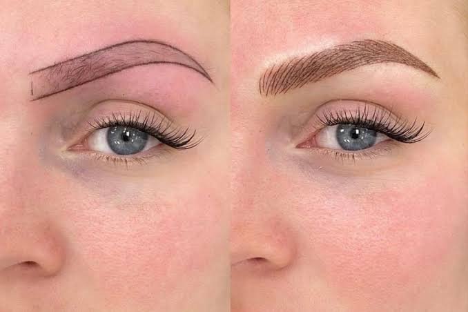 It is a semi-permanent makeup procedure to improve the aesthetics of your eyebrows.