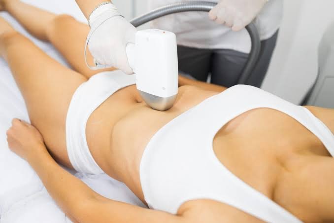 Bikini Laser