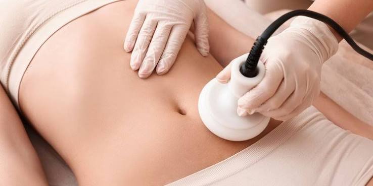 Cavitation