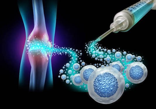 Stem Cell Therapy (Bone Marrow)